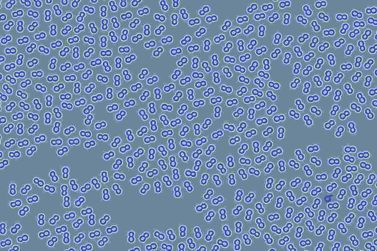 Le illusioni ottiche sono un argomento affascinante che ha catturato l'attenzione di scienziati e artisti per secoli.